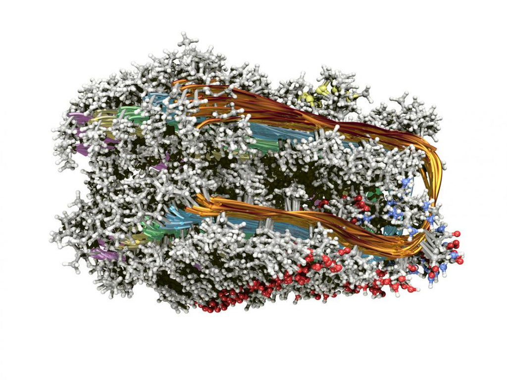 Human enzyme may be key to unraveling Alzheimer's disease